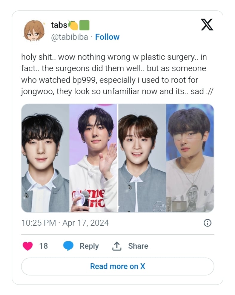 Айдол пятого поколения вызвал слухи о том, что он сделал пластическую операцию, шокировав корейских нетизенов своей изменившейся внешностью